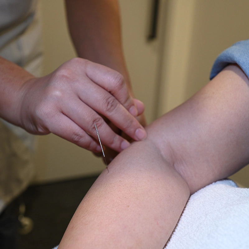 Healing-Moments-Massage-and-Acupuncture-on-patient