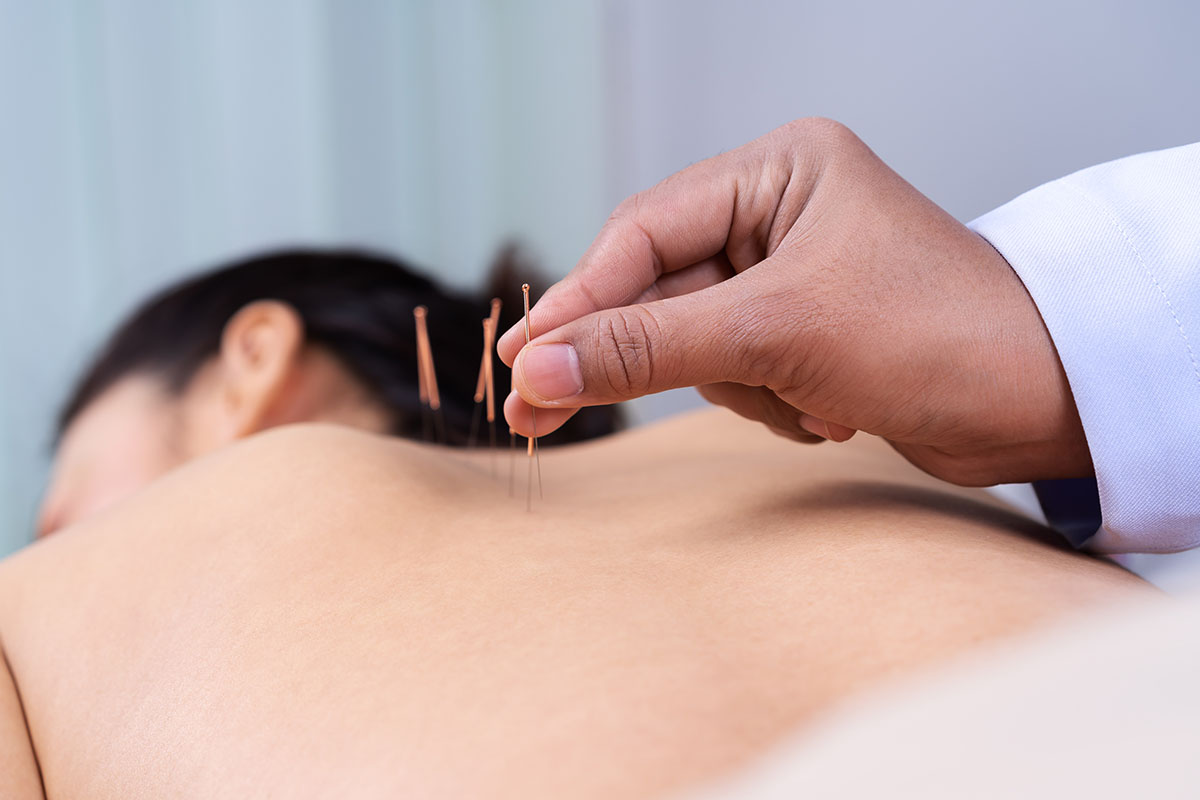 Acupuncture for women's health issues