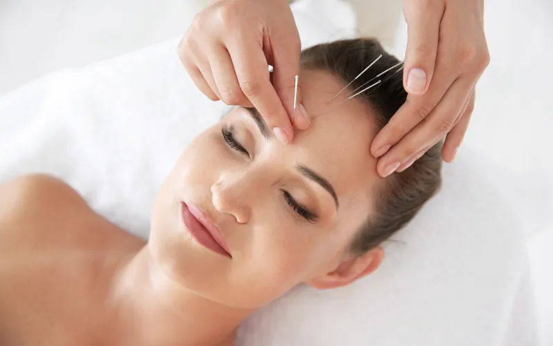 female acupuncture