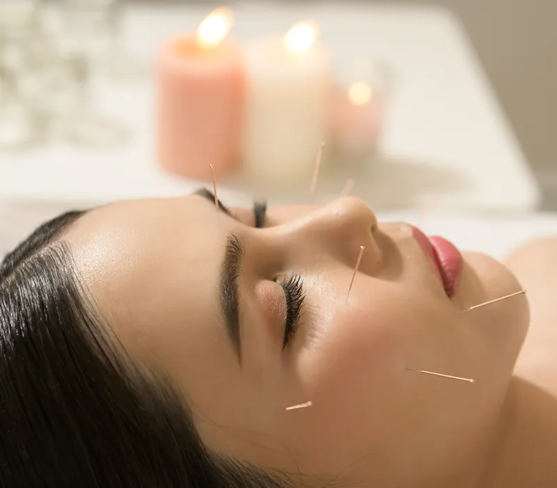 female face acupuncture