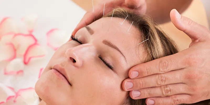 female forehead acupuncture