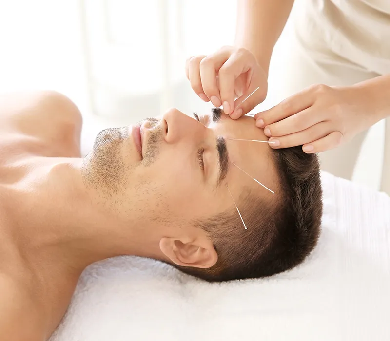 male acupuncture